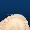 Advanced Dental IPS Emax for Restoration